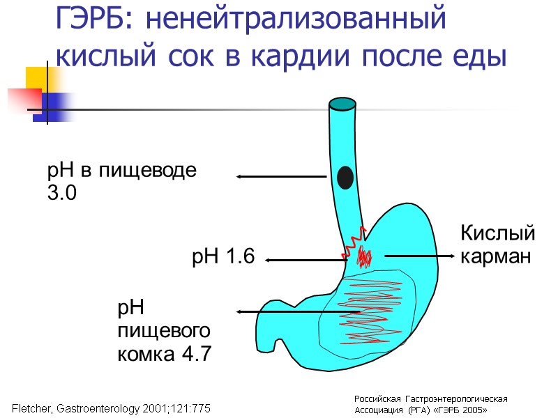 ГЭРБ: ненейтрализованный кислый сок в кардии после еды pH в пищеводе 3.0 pH 1.6